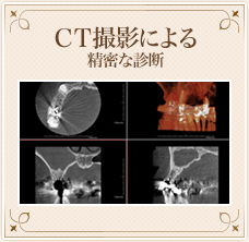 CT撮影による精密な診断