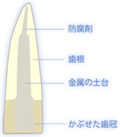 歯の根の断面図