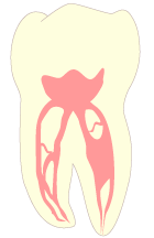 根管の構造