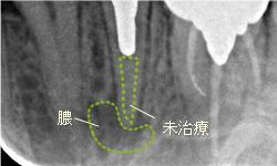 術前