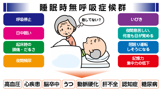 睡眠時無呼吸症候群の症状のイラスト