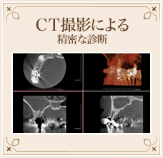 CT撮影による精密な診断